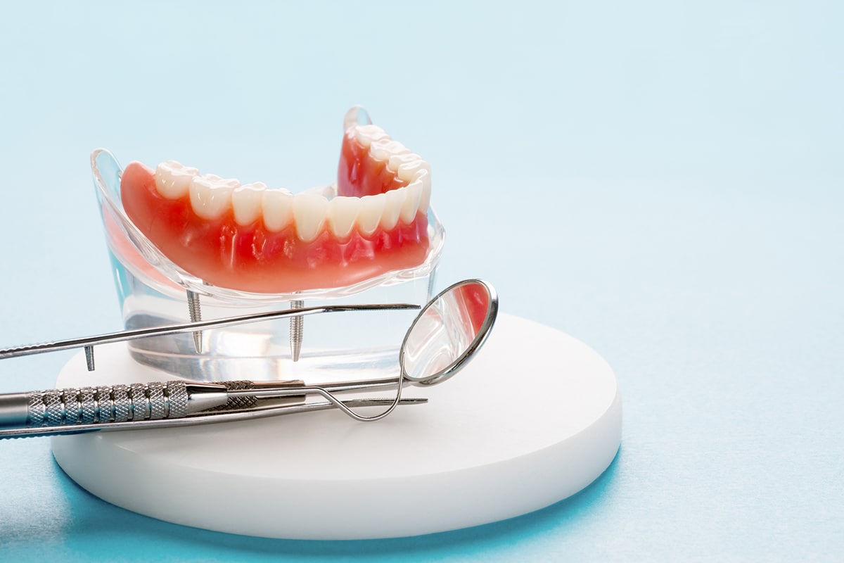 All-On-4® vs. Traditional Dentures: Which Is Right for You?